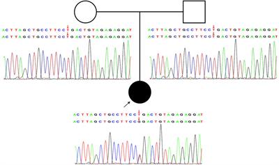 Case Report: A Novel De Novo Missense Mutation of the GRIA2 Gene in a Chinese Case of Neurodevelopmental Disorder With Language Impairment